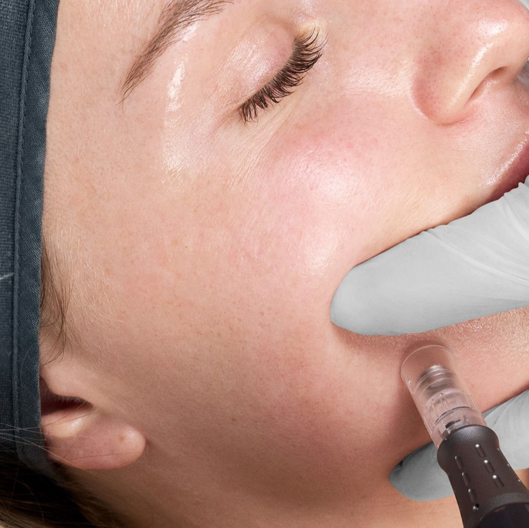 dermalogica pro 5